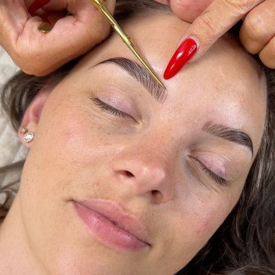 Brow Lift